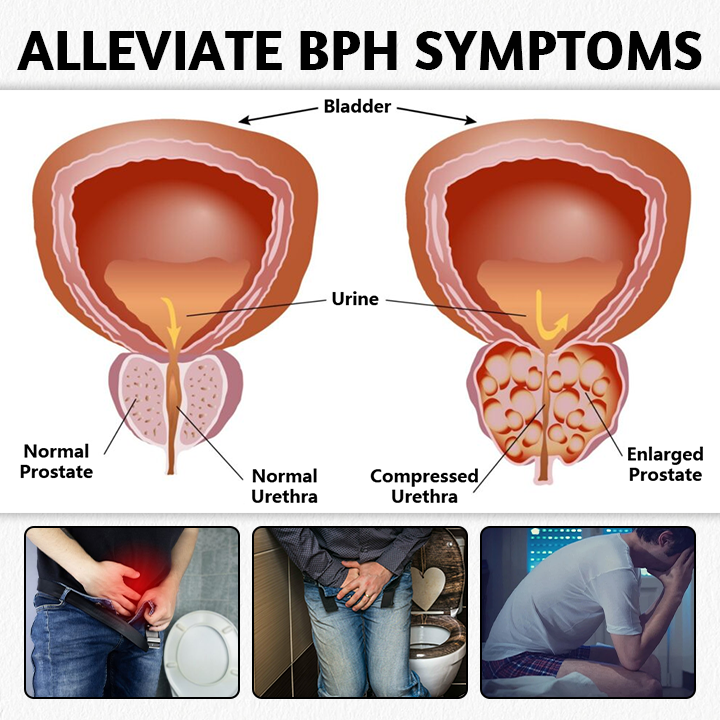 （✨LAST DAY SALE-82% OFF✨) Medazy™ Prosta Magnetic Harmony Ring